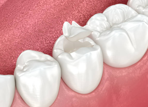 Best Dentures (Full and Partial)  in Newark, NJ